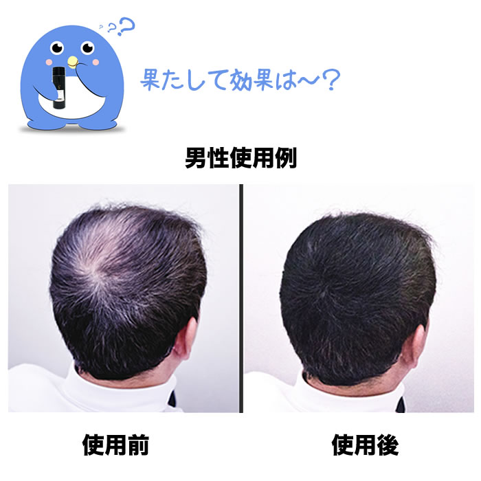 市場 増毛パウダー 3点セット 専用ヘアミスト + 詰め替え用 ダークブラウン 30g 50g シークレットプラス