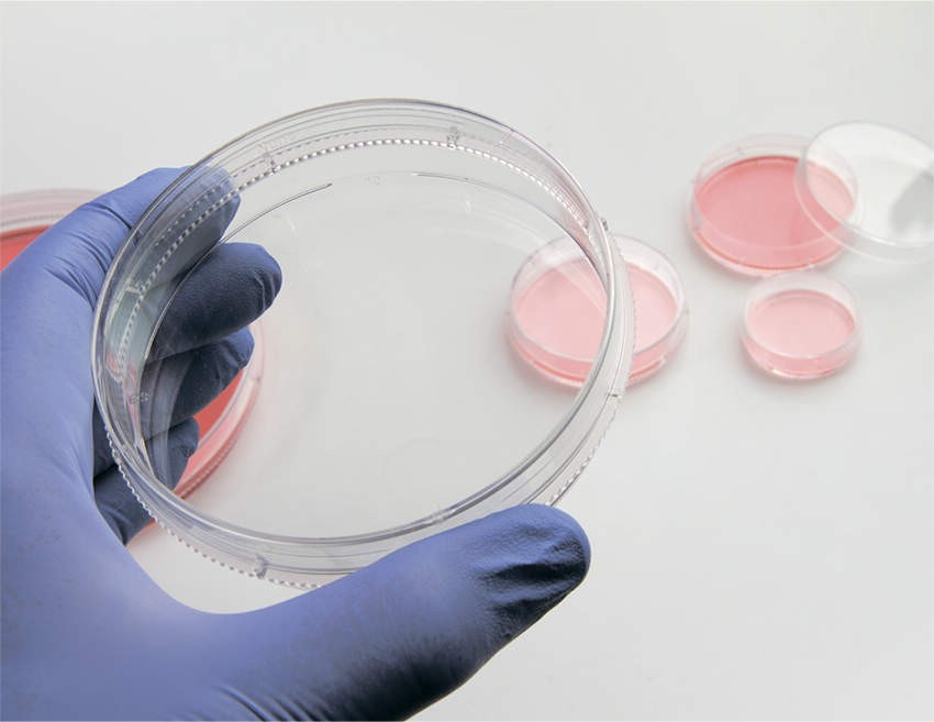 Thermo Fisher Scient イージーディッシュ 60mm 150462 280入|ハカルドットコム 店