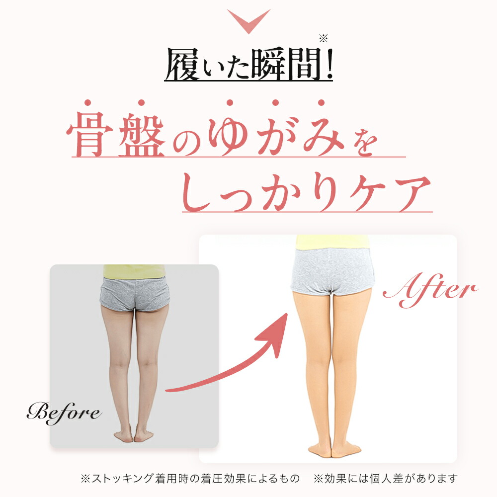 25%OFF｜10/20 23:59まで ] ＼湘南美容クリニック 開発／ 着圧