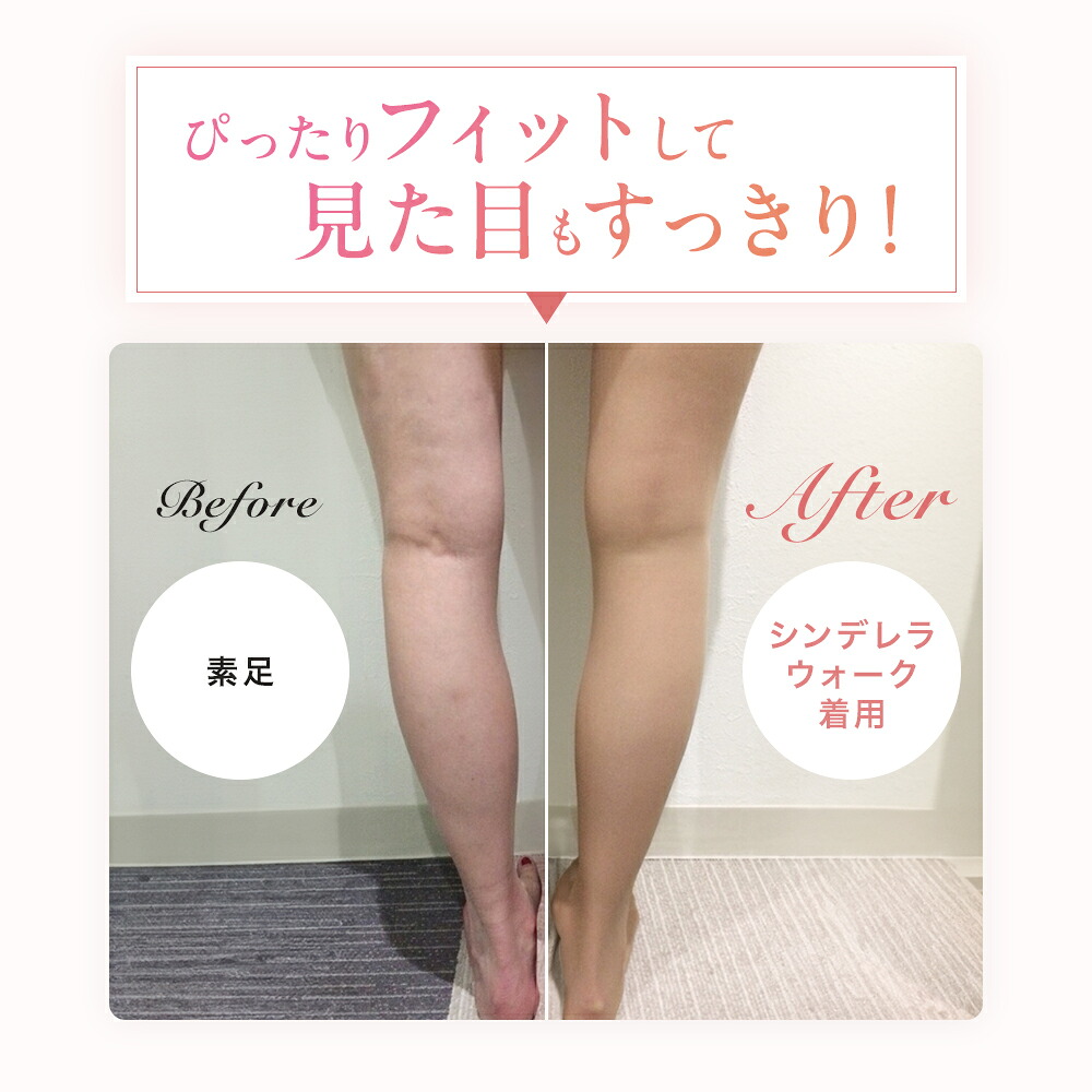 25%OFF｜10/20 23:59まで ] ＼湘南美容クリニック 開発／ 着圧