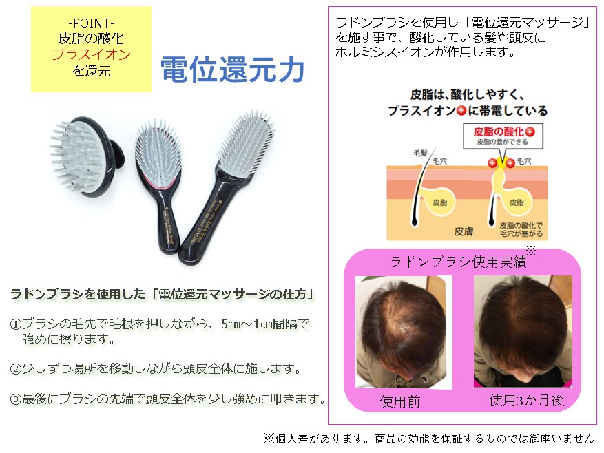 シャンプーブラシ Er 100c 10 4までポイント10倍 送料無料 ラドンブラシ ラジウム鉱石 エナジーラバー 頭髪 ブラシ コイノテックス Mavipconstrutora Com Br