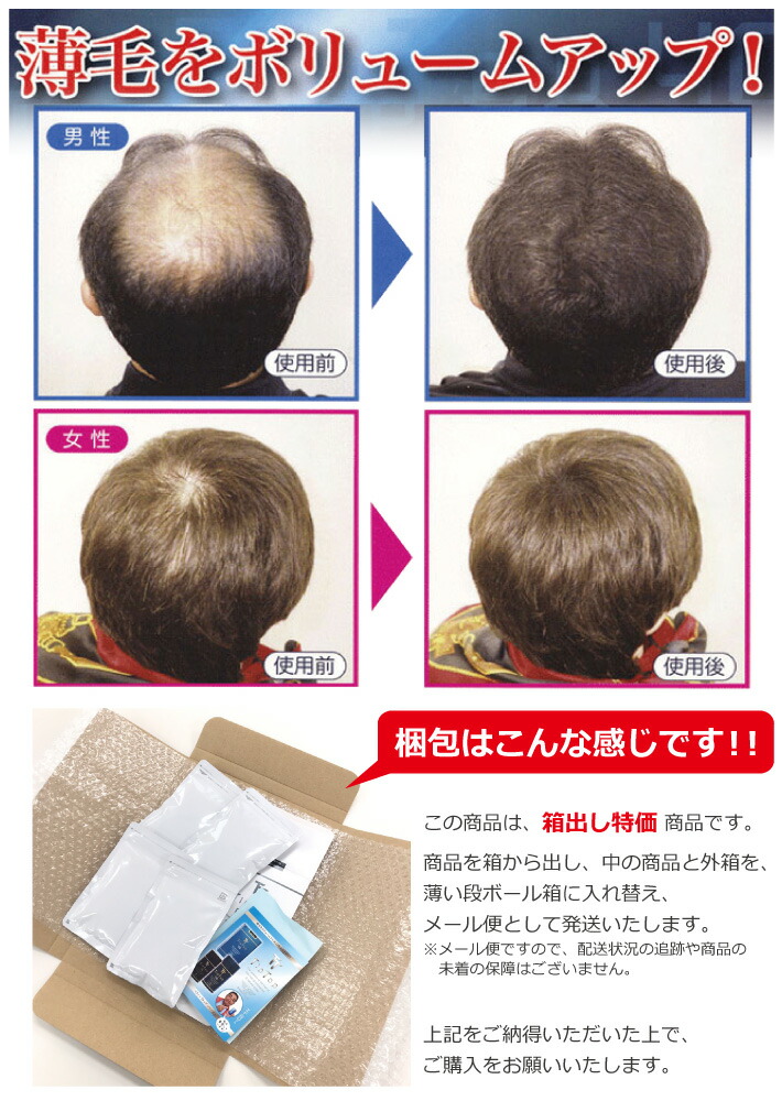 Esco Shop 80 G Of Tiptop I Sprinkle A Concealment Of Thin Hair