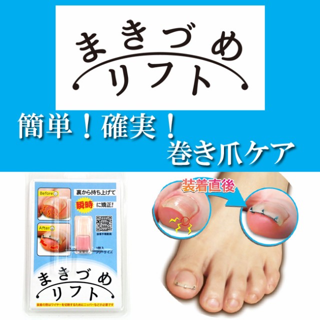 まきづめリフト1個入りフリーサイズML1巻き爪ケアまき爪矯正フリーサイズ巻爪ケア矯正ワイヤー爪やすり付き裏から持ち上げ瞬時に矯正一般医療機器DM便送料無料