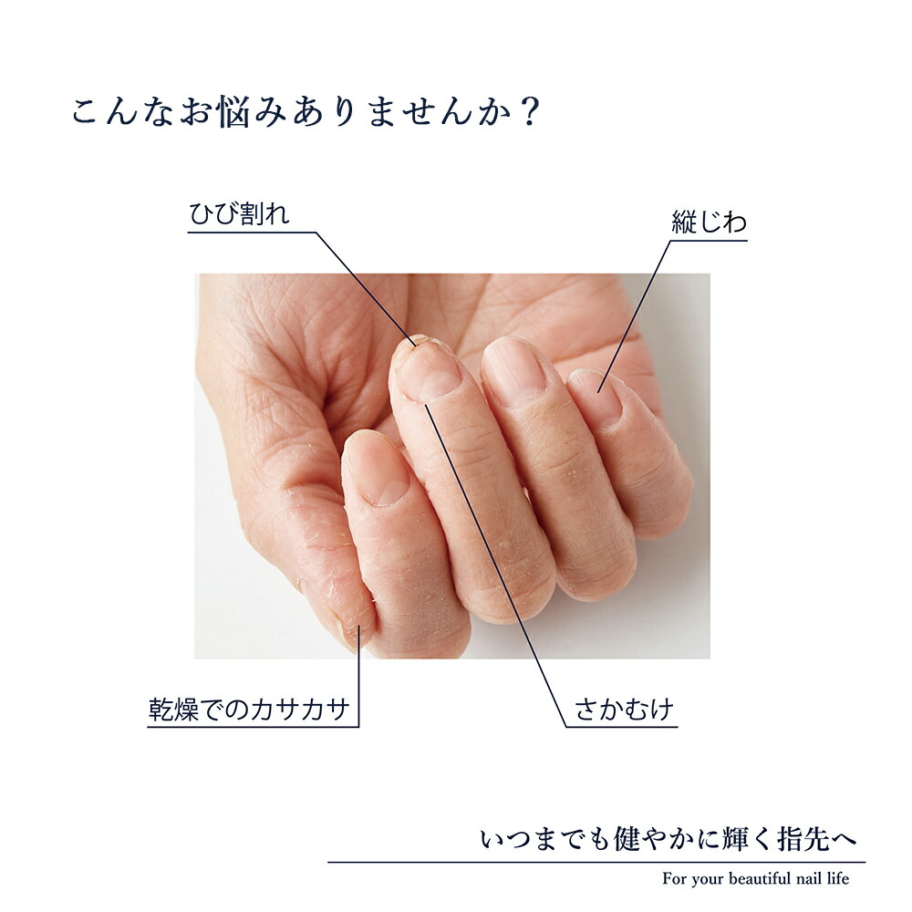 楽天市場 Nailbase ネイルベース 甘皮オイルと爪の美容液のセットネイル 天然オイル ネイルケア 自爪 セルフネイル セルフケア 国産 自爪 ケアグッズ 女性 男性 プチギフト お返し ギフト プレゼント お祝い あす楽対応 ギフト雑貨 Anniversary World