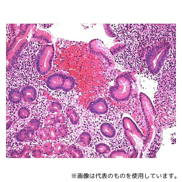 いき込み症から守る空調設備御召しもの