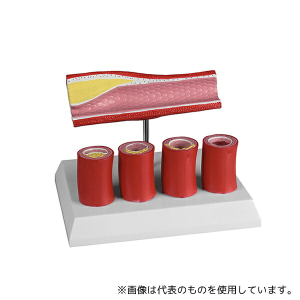 Erler-Zimmer G240 動脈硬化モデル