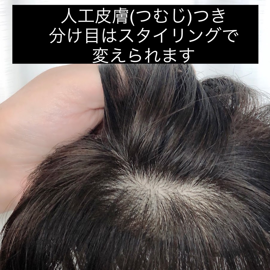 楽天市場 広範囲の薄毛に 人毛100 頭頂部カバーウィッグ ワイド ロングヘアー用 30cm つむじあり レミーヘア ヘアピース かつらウイッグトップピース部分ウィッグ総手植え 脱毛症 脱ウィッグ 円形脱毛症 薄毛 薄毛かくし 白髪かくし 抗がん剤 抜毛症 びまん性脱毛