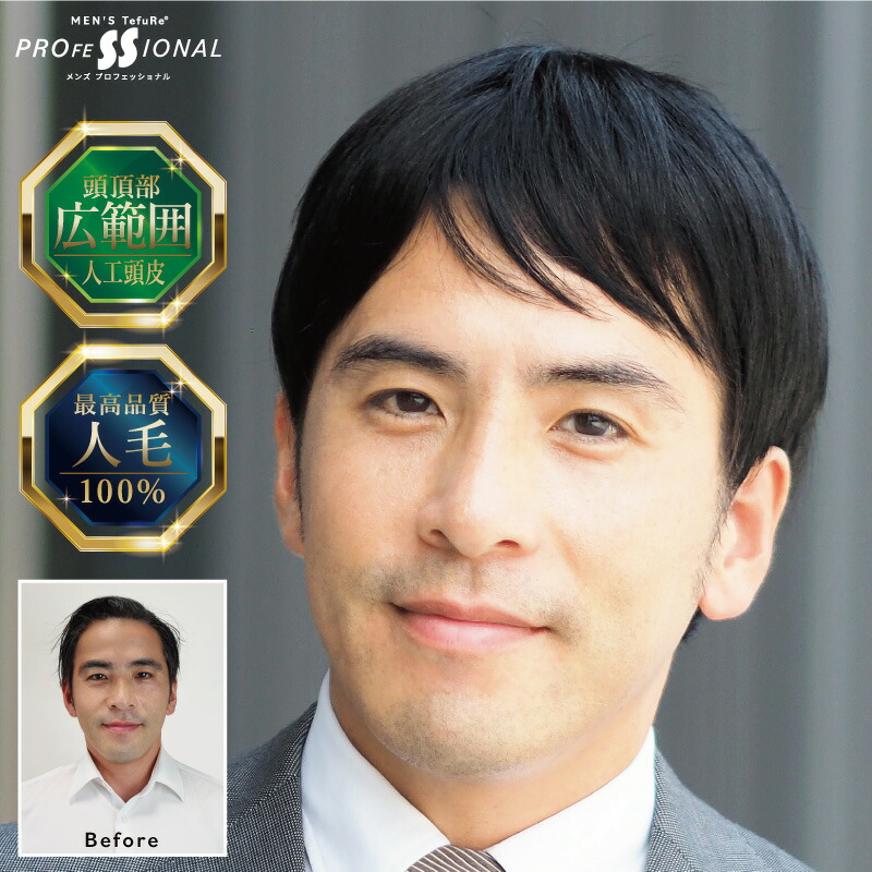 【店卸し資産区分け】バレない メンズウィッグ 人毛 ウィッグ 成人男性用 メンズ 白髪 薄毛 脱毛症 頭頂部 増毛 かつら 気取らない 黒いこと 【シンプルショート】