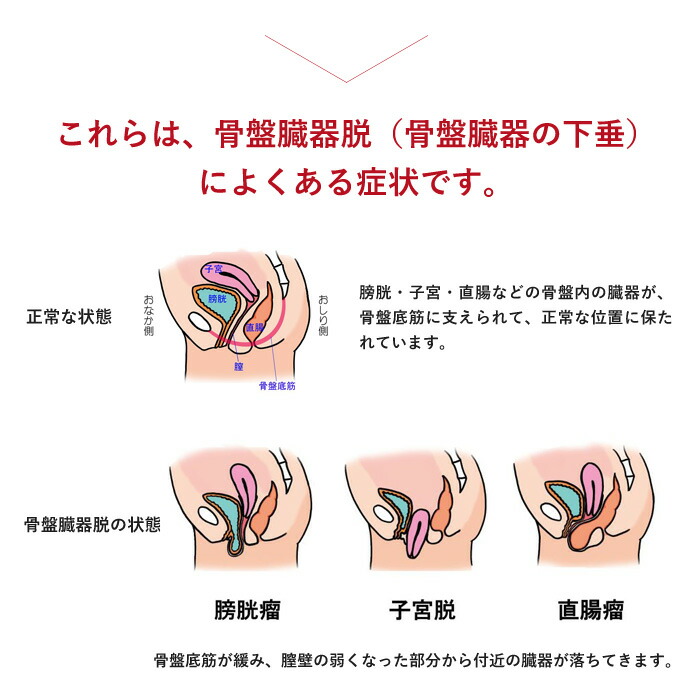 スーパーsale お得なクーポン配布中 排尿障害 アダム医健 骨盤底サポーター 子宮 軽度失禁用品 脱 下着 一般医療機器 一般医療機器 頻尿 尿失禁 尿漏れ 尿トラブル 排尿障害 排便障害 Fuwalu フワル 緩んできた骨盤底筋をしっかり支え 骨盤臓器の下垂を防ぎます