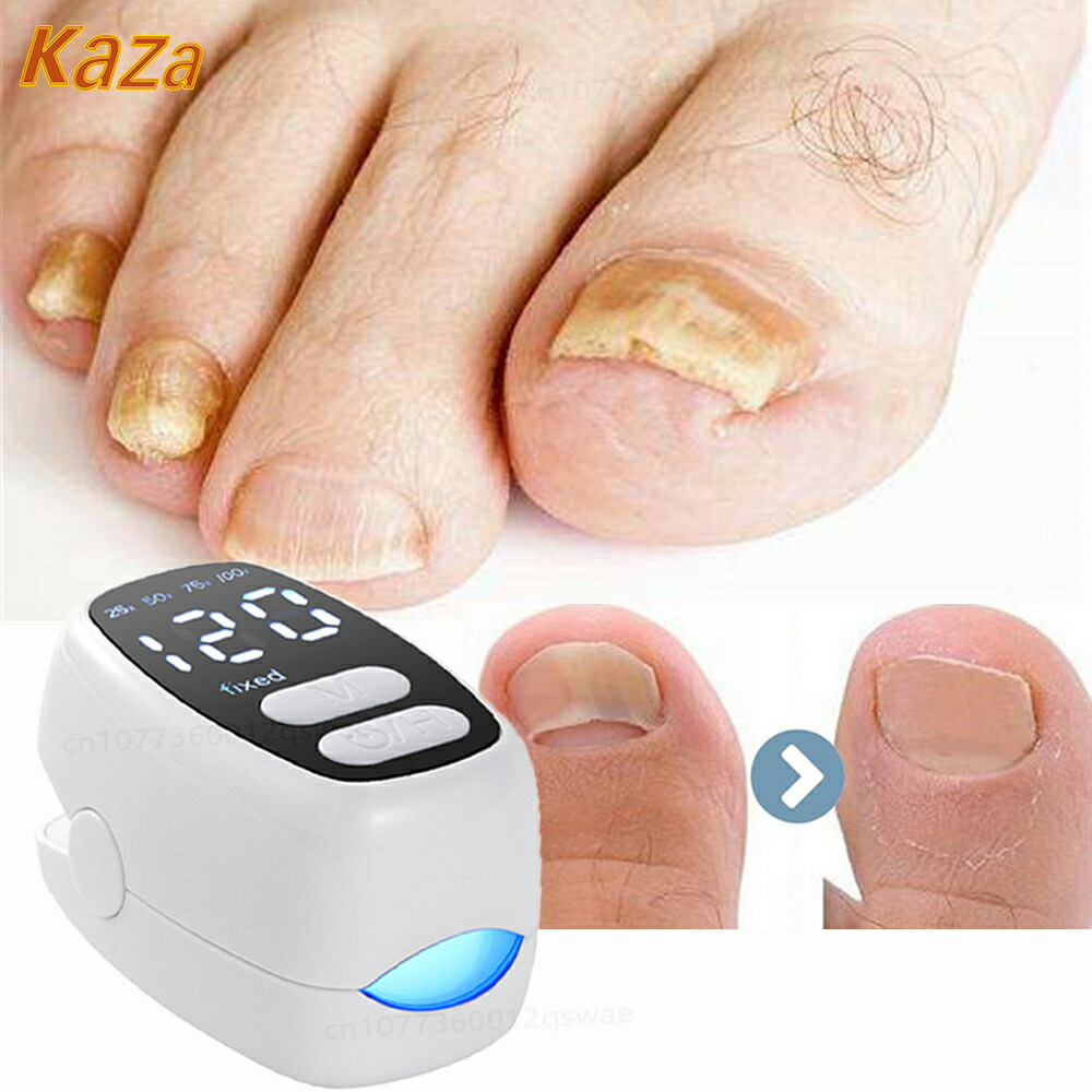 値下げ　New UVフットケア Amazon.co.jp: ニュー UVフットケア CUV-5 紫外線治療器 : ビューティー