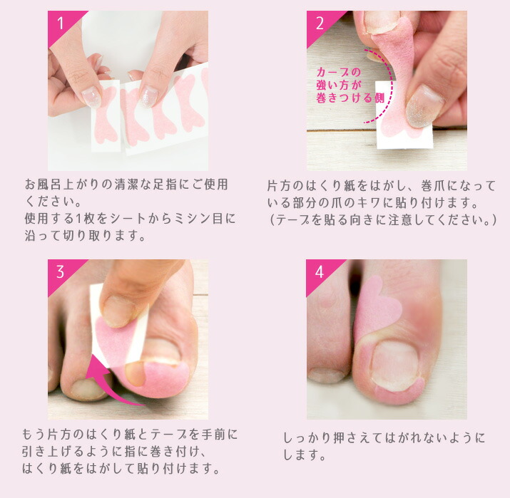 楽天市場 2つまでネコポスでのお届け 巻爪 ガードテープ テーピング 使い捨て 伸縮 医療用 巻爪対策 巻爪予防 18春夏 枚入り F 巻爪ガードテープ 枚入り キュットスリムと下着通販gb Style