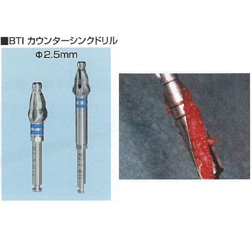 医療機器 クラスI 【一般医療機器】 BTI歯科用ドリルシリーズ BTI 骨採取用ドリル BTIカウンターシンクドリル 直径2.5mm(S・L)