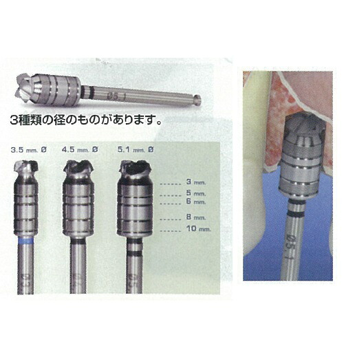 診療設備 社会階級I 【原則として診療設備】 BTI歯科用せん孔機続きもの BTI フロントカッティングドリル 差しわたし5.1粍