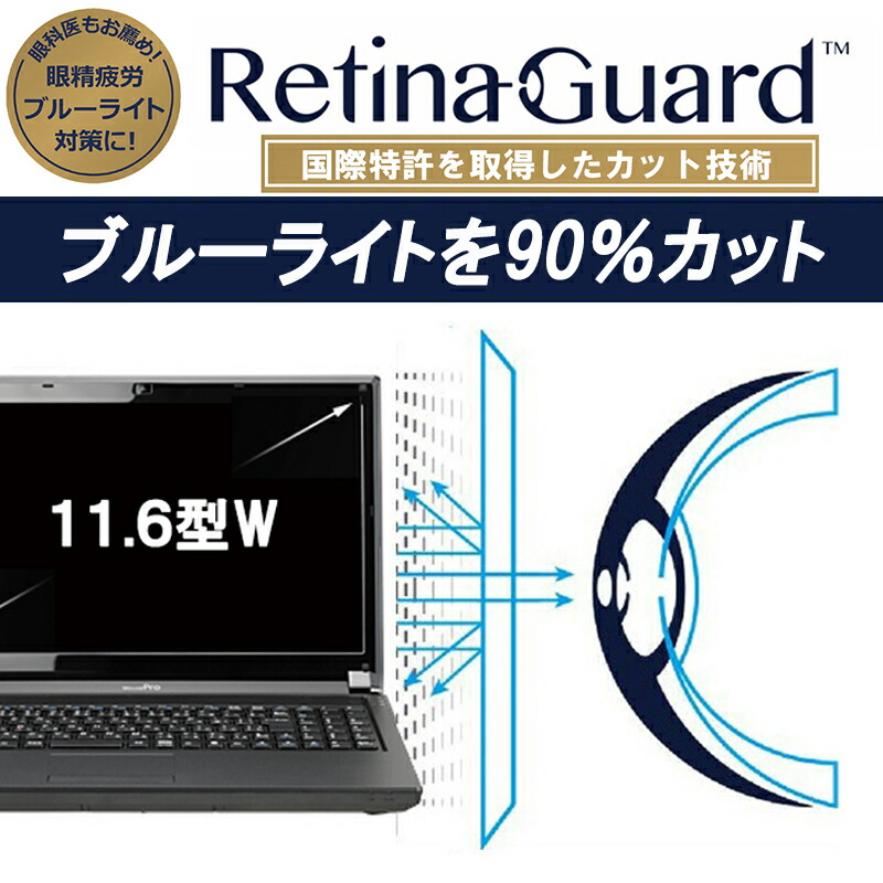 楽天市場 Retinaguard 11 6 型 ワイド ノート Pc パソコン ブルーライト90 カット 保護フィルム 国際特許 液晶保護フィルム 保護シート 保護シール Vaio バイオ Lenovo レノボ Acer エイサー 東芝 Dell デル Asus ブルーライトカット フィルム 11 6インチ Glance