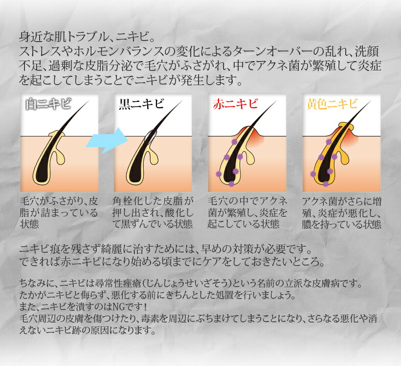 市場 アクネ ニキビケア専用 美ルル アクネ菌 ニキビ ケア 美顔器 光エステ For 青色led 市場 アクネ ニキビケア専用 美ルル アクネ菌 ニキビ ケア 美顔器 光エステ For 青色led