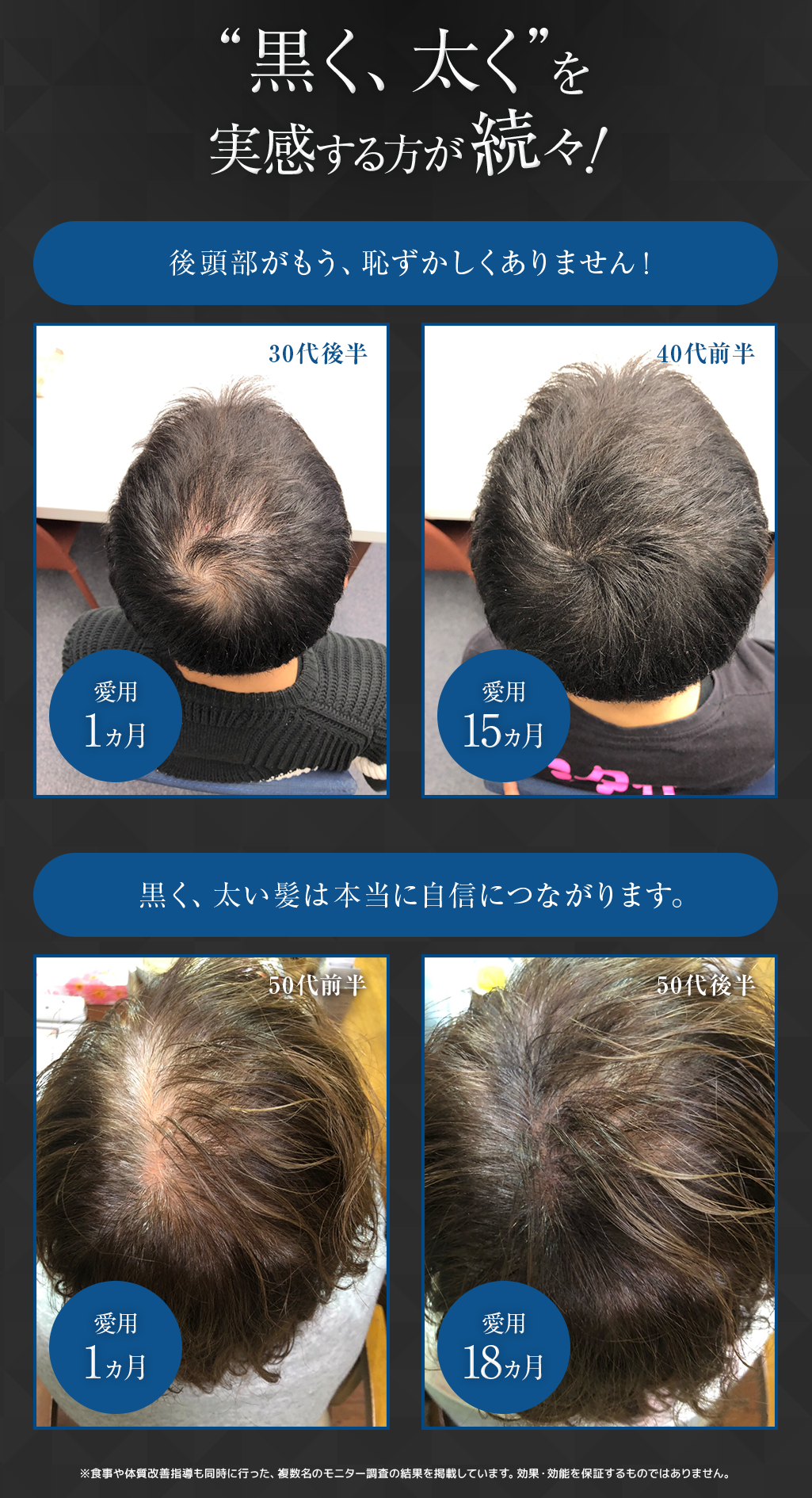 楽天市場 薄毛 白髪 対策 育毛剤 グロキシル ヘアトニック サプリ 特許成分 高濃度配合 男女兼用 養毛剤 髪 ボリューム 育毛 男性用 女性用 頭皮ケア 頭皮 抜け毛 予防 白髪 ローション 薬用 黒髪 医薬部外品 女性 薄毛 対策 育毛トニック マスター コスメティック公式