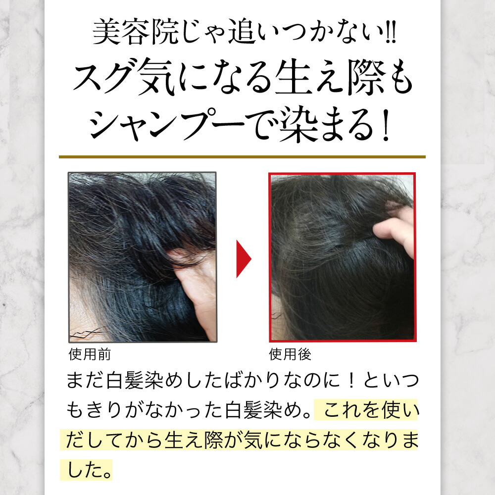 バランローズ Kuroクリームシャンプー 3個セット ナチュラルブラウン Valanrose Kuro Cream Shampoo 400g シャンプー クリームシャンプー ヘアカラー 白髪 髪 ヘアケア 白髪染め 黒 Kuro クロ トリートメント Mpgbooks Com