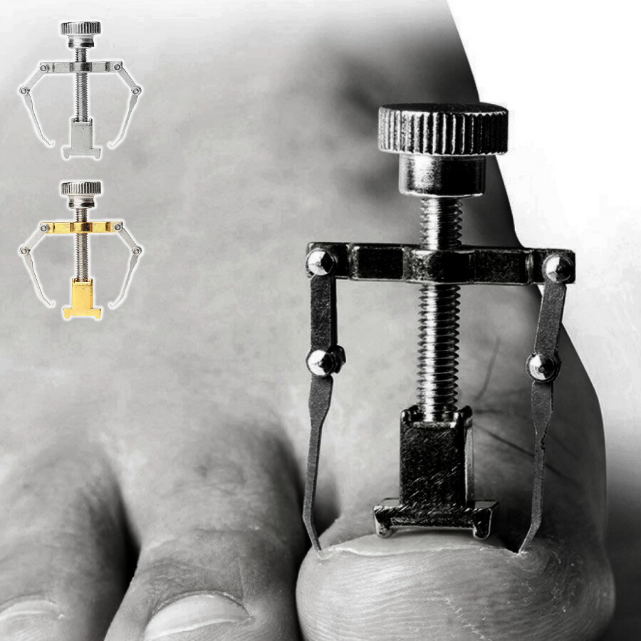 楽天市場】【送料無料】オニクリップ巻き爪ケア スターターセット