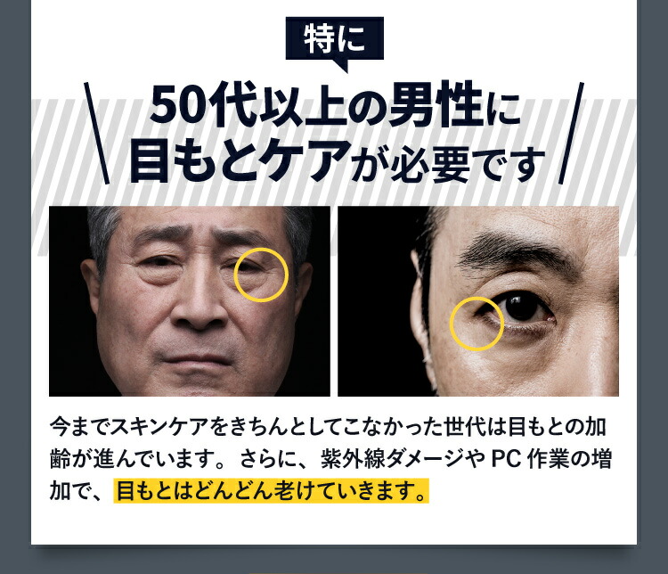 楽天市場 アイクリーム 目の下 たるみ 解消 ストレッチアイズ夜用 1本 約1ヶ月分 目の下のたるみ 保湿 目元クリーム 男性 女性 メンズ レディース 涙袋 ほうれい線 オススメ 健康食品の店グリーンハウス