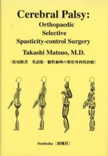 脳性麻痺の整形外科的治療 Cerebral Palsy Orthopaedic Selective Spasticity Control Surgery 英語版 Partydekoracija Com