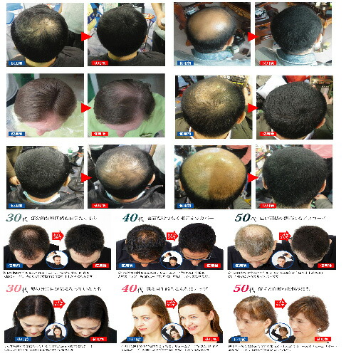 Healthy7 I Sprinkle The Lady S Black Dark Brown Fiber Baldness