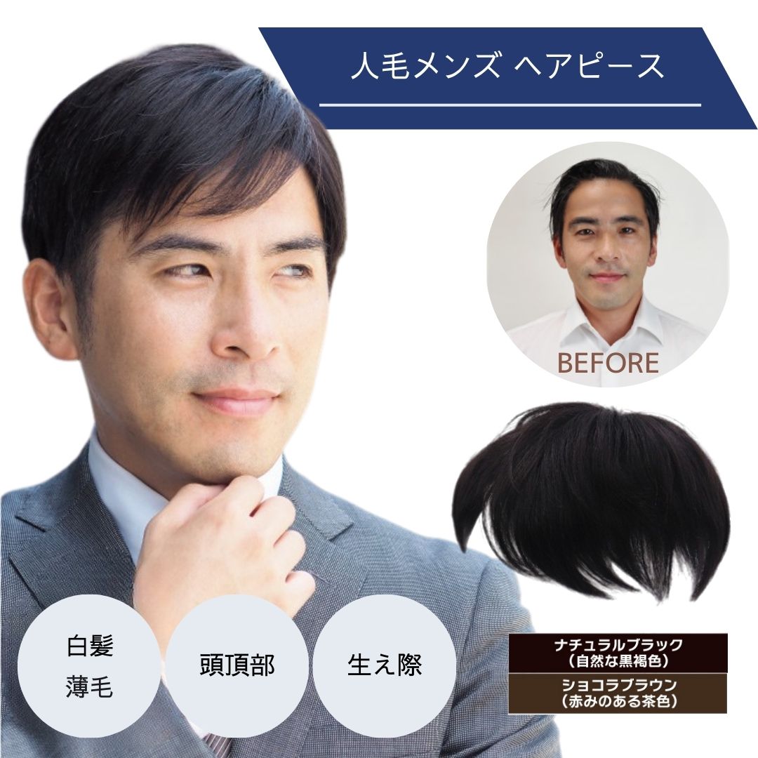 分け取りカツラ 頭頂部 成人男性 薄毛つつみ隠し 人毛 気どらずに ウィッグ メンズ バレない 生え際 前髪 危急存亡の時 つむじ 薄毛 白髪 循環脱毛症 植毛 増毛 音の大きさ 蒸れない 黒いこと 赤銅色 黒 茶髪 TefuRe MY-341