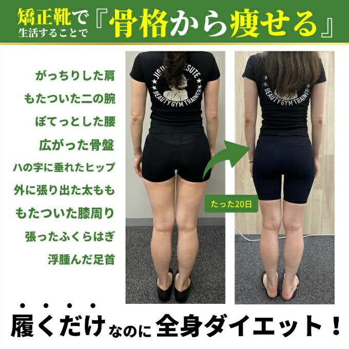Racbaki ラクバキ ダイエットサンダル -5kg サンダル -5kg サンダル
