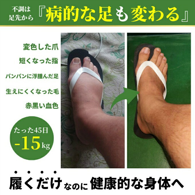 Racbaki ラクバキ ダイエットサンダル -5kg サンダル -5kg サンダル