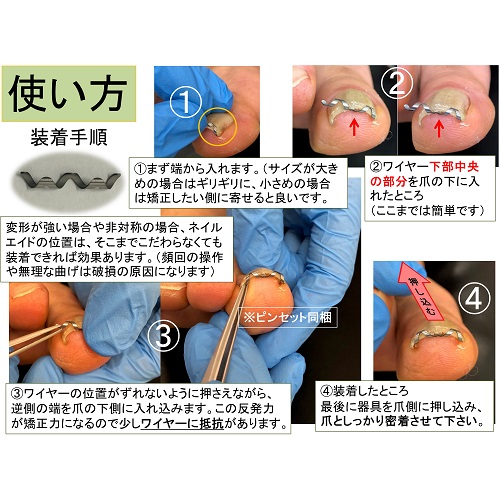 楽天市場 巻き爪 矯正 自分で 治療 ネイル エイド ワイヤー クリップ 爪切り ロボ ブロック テープ リフト 靴 やすり 巻爪 原因 16mm 巻き爪 陥入爪治療の相談室