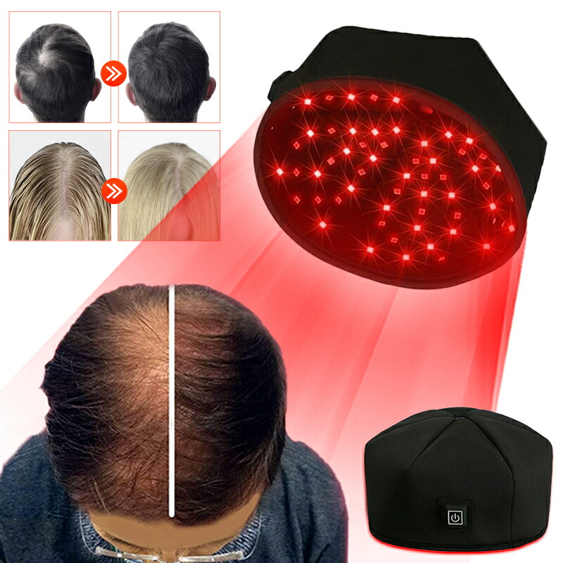 育毛・発毛促進器具 楽天市場】LED赤色光育毛ヘルメット 育毛ヘルメット 育毛