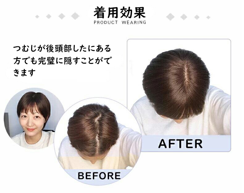 【楽天市場】人毛100％ 部分ウィッグ ヘアピース 自然 つむじ 分け目自由 総手植え 前髪 頭頂部 前髪ウィッグ 白髪隠し 薄毛 抜毛症