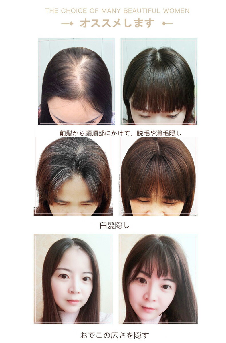 送料無料 ヘアピース 人毛100 つむじ付き 部分ウィッグ 部分ウィッグ 縦長 分け目 ロング 人工皮膚付き 人工皮膚付き 前髪有り ロング 医療用 人毛 ウィッグ セミロング ミディアム レディース 総手植え かつら ポイントウィッグ カバーピース 円形脱毛症 抜け毛 薄毛