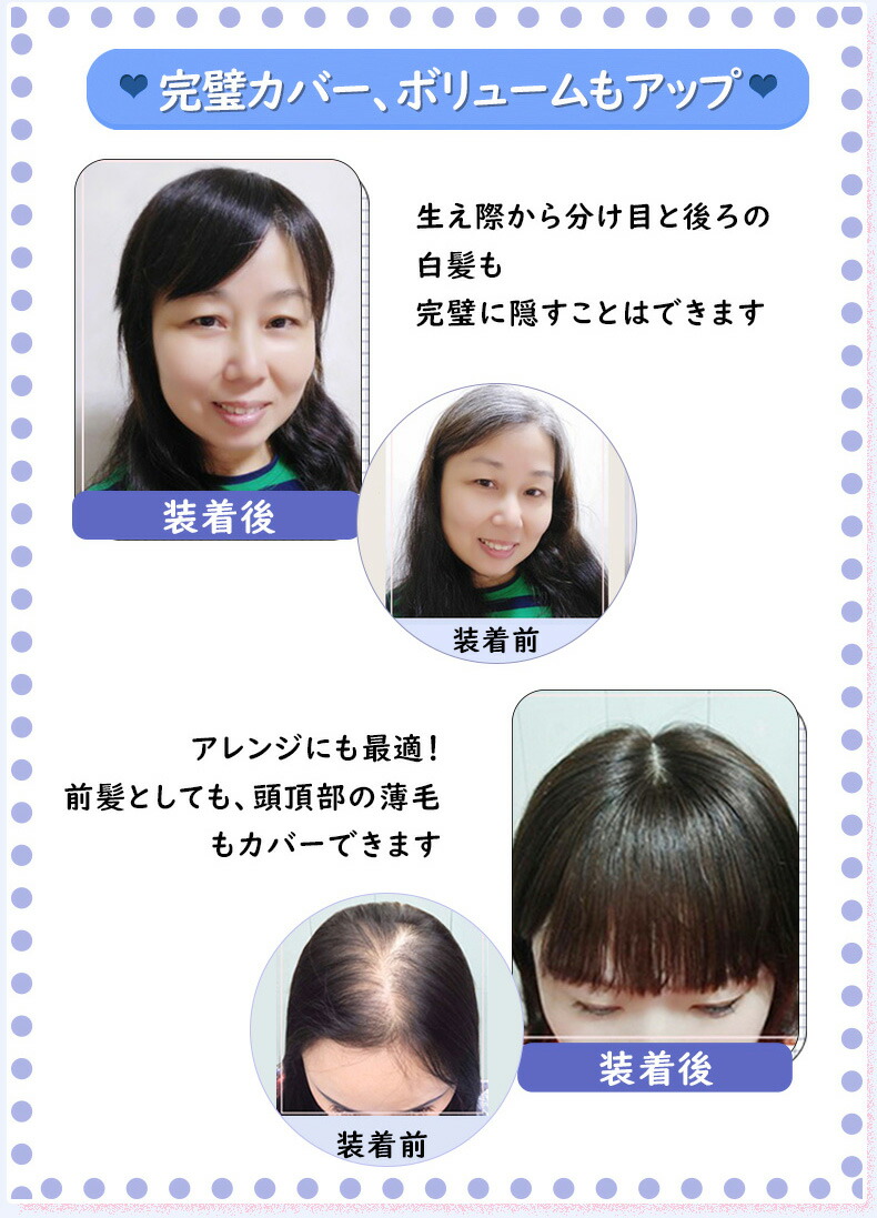 前髪ウィッグ カツラ 分け目 ウィッグ専門店人毛ヘアピース ボリュームアップ 手植え 前髪あり つむじ 薄毛 人工頭皮 かつら 医療用 脱毛 総手植え ヘアピース つむじ付き 人毛軽い 人毛100 ミディアム 分け目 リアル セミロング 医療用 女性 白髪染め 薄毛 増毛 医療用