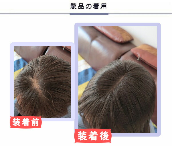 楽天市場 つむじ 人毛100 医療用 つむじ 部分 ヘアピース かつら 女性 メンズ 手植え 白髪隠れ 前髪ウィッグ 自然 部分ウィッグ7 10 楽天海外直送 Hiye ウィッグ専門店