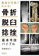 楽天市場】新版 橈骨遠位端骨折 進歩と治療法の選択 The Cutting Edge