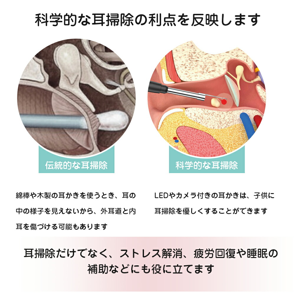 新着 耳かき みみかき カメラ 付き 耳鏡 内視鏡付き耳かき イヤースコープ 耳掃除 超小型レンズ 4.5mm 300万画素 WIFI接続 ステンレス  LEDライト付き 無線 視覚耳取り USB充電 APP iphone Android 子供 ES01-1 newschoolhistories.org