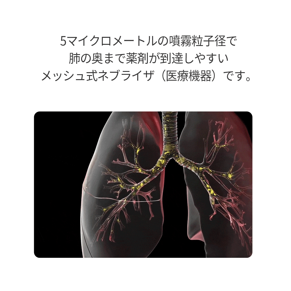【医療機器認証取得】メッシュ式ネブライザ喘息用吸入器喘息ネブライザー吸入超音波噴霧携帯子供子ども大人薬のど肺コンパクト静音軽い軽量家庭用携帯用薬液簡単操作保管ケース付きマスクマウスピースヒュービディックHuBDIC
