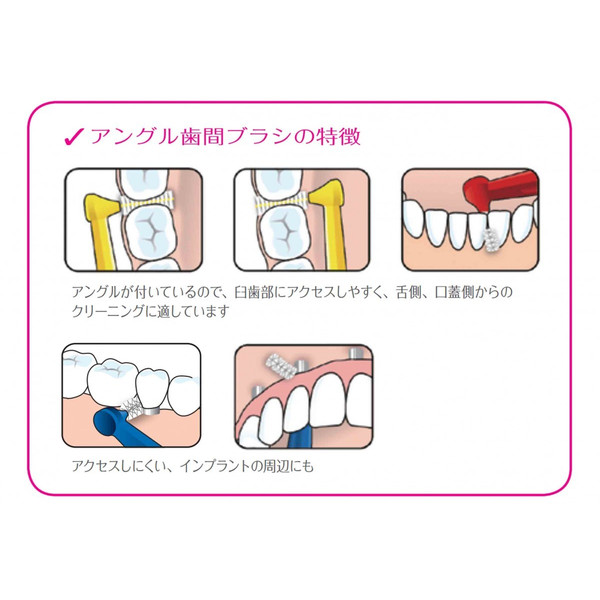 爆安 テペ TePe アングル歯間ブラシ３パック turbonetce.com.br