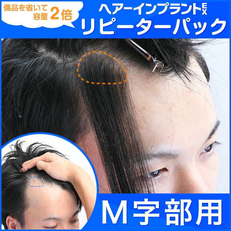 リピーターパック ヘアーインプラントEX Ｍ字用※強力テープ貼り付け済み 【正規販売店】