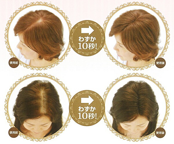 楽天市場 スーパーミリオンヘアー レディースセット ふりかけ増毛 インクリーズヘアー