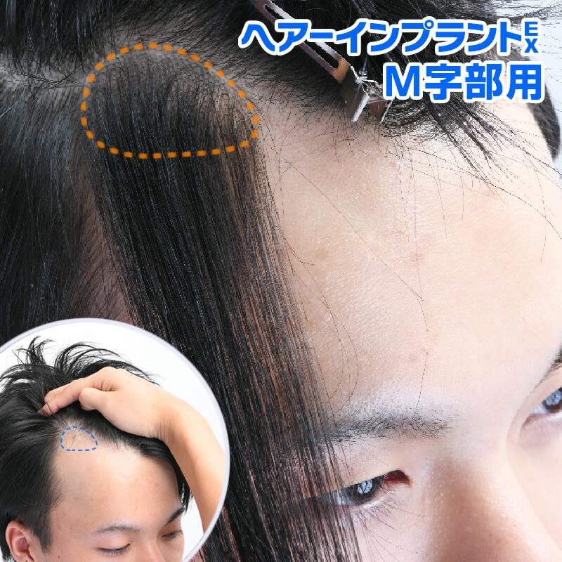 インクリーズヘアーの実バス発着場