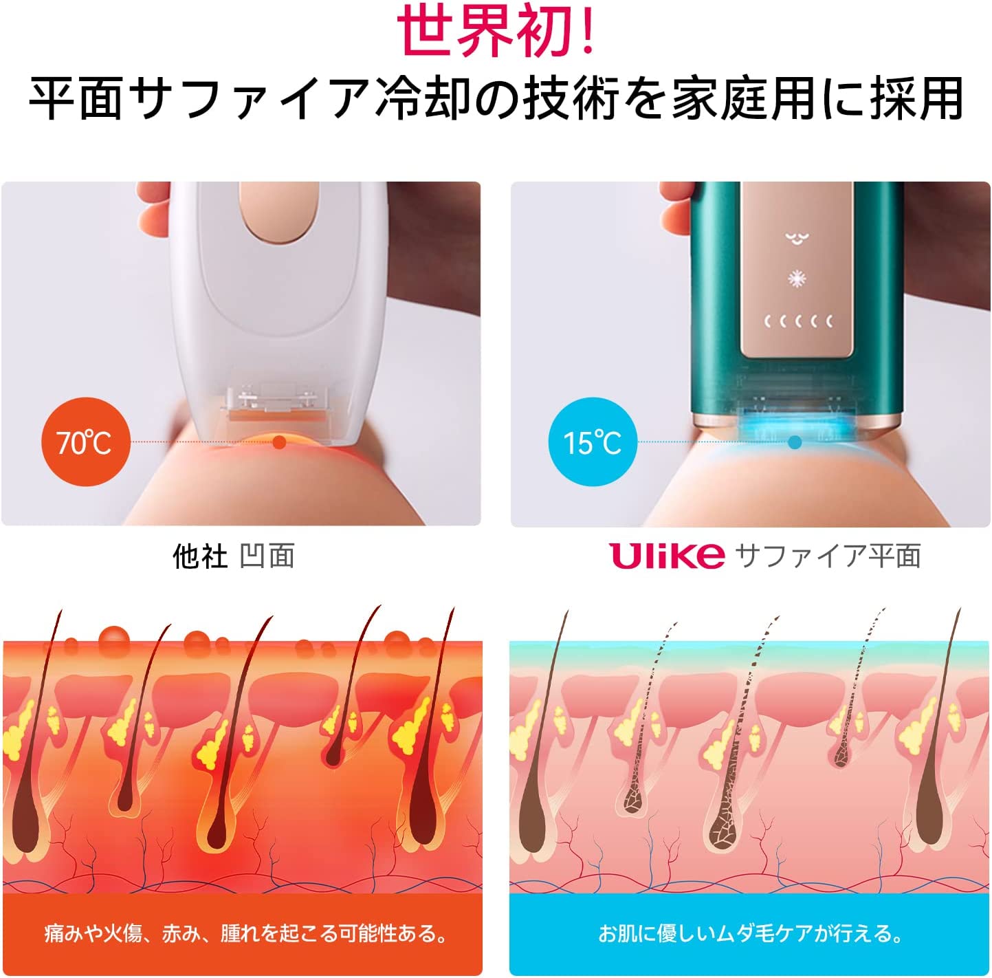 変革のパワーを授ける・願望成就 Ulike?Air?Pro IPL光美容器 脱毛器