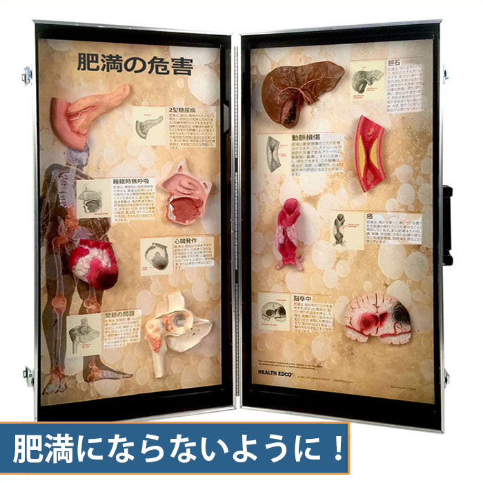 肥満が招く健康リスクをリアルな模型で学ぶ研修教材。特定保健指導や栄養指導の説得力を高め、減量への動機付けを強力にサポート。管理栄養士や保健師のメタボ対策セミナーに。健康経営の第一歩にも。｜人体百科　店