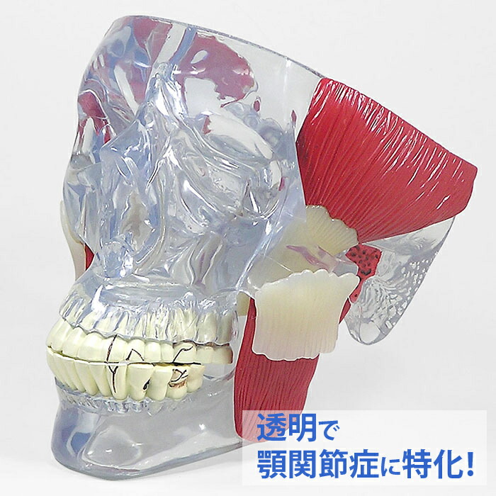 人体模型 顎関節 顎関節症 TMJ OM-GP-2880 GPI Anatomicals 透明 歯科 口腔外科 患者説明 医学 学習用 教材 送料無料|人体百科 店