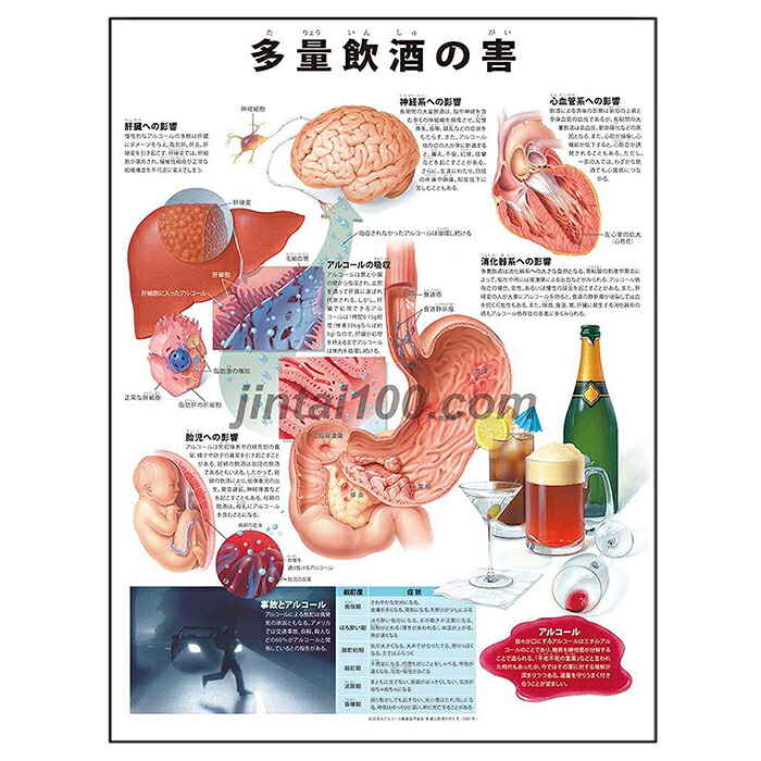 【楽天市場】過度飲酒の害 保健教育ポスター J9696P 飲酒運転 アル中 アルコール依存症 人体図 医学ポスター 医学チャート:人体百科 楽天市場店