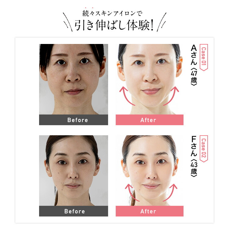 公式】スキンアイロン SKIN IRON 正規代理店 レビュー特典あり