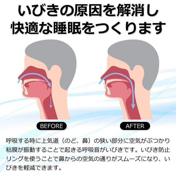 楽天市場 いびき防止グッズ いびき いびき対策 睡眠グッズ 指輪 いびき リング イビキ 防止 いびき 防止リング 送料無料 東京セレクト