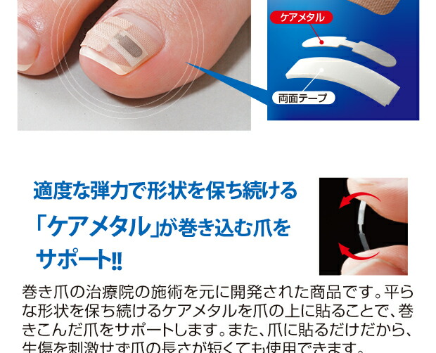 楽天市場 4個セット 巻き爪 矯正 テープ シール型 巻き爪 サポーター シール 目立ちにくい 巻き爪ケア 保護シール 足の爪 足指 足爪 痛み 軽減 改善 ケアメタル 貼るだけ かんたん 巻爪 保護 44 低糖質 糖質制限の快適空間２２２