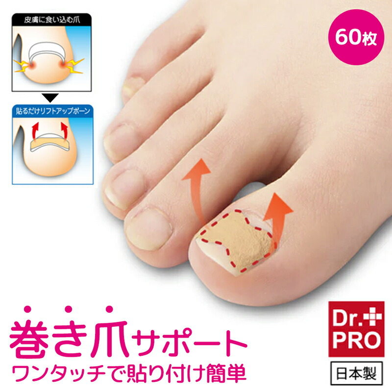 楽天市場 巻き爪 矯正 自分で 治療 ネイル エイド 16mm ワイヤー クリップ 爪切り ロボ ブロック テープ リフト 靴 やすり 巻爪 原因 金具 16mm 巻き爪 陥入爪治療の相談室