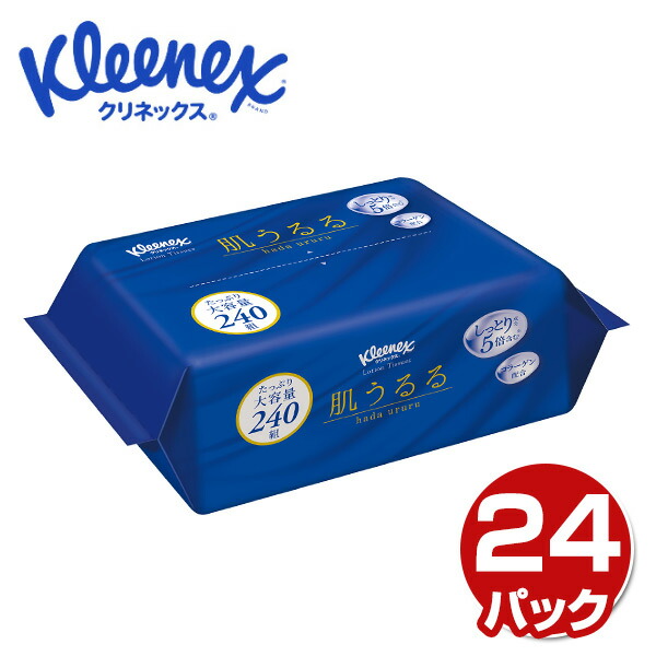 山善のトローリー